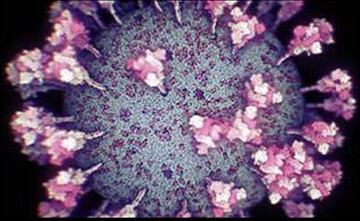 جدیدترین و دقیق‌ترین تصاویر از ویروس کرونا منتشر شد