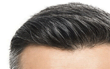 افزایش تراکم مو با ۵ روش خانگی