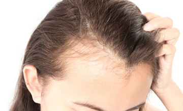 اینفوگرافیک | این ۶ علامت در موهایتان یعنی بدن شما در خطر است