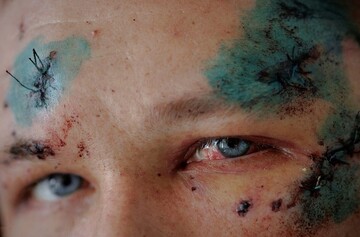 ببینید: ۱۱۰ عکس برگزیده و تاثیرگذار از جنگ اوکراین