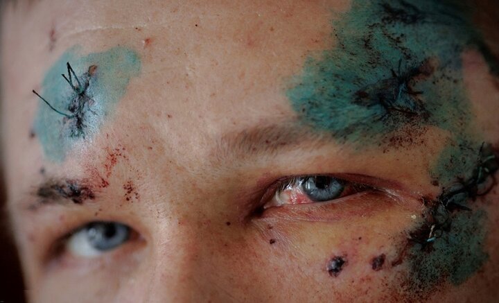  ببینید: ۱۱۰ عکس برگزیده و تاثیرگذار از جنگ اوکراین