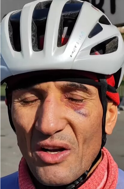 حمله با پنجه بوکس به دوچرخه‌سوار ایران+ عکس