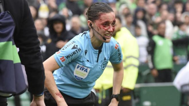 خونریزی شدید و مصدومیت یک داور زن فوتبال + تصاویر