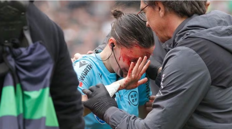 خونریزی شدید و مصدومیت یک داور زن فوتبال + تصاویر